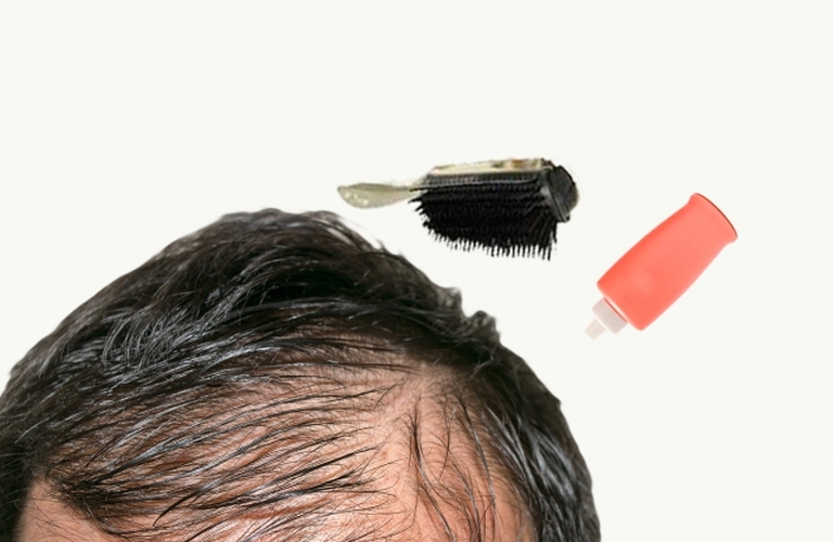薄毛対策・AGA治療をお考えの男性女性のお悩みを解決するなら日本橋のB・Makesにお任せ下さい！